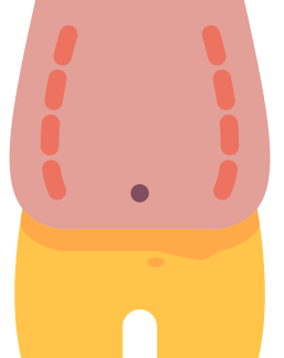 Abdomen